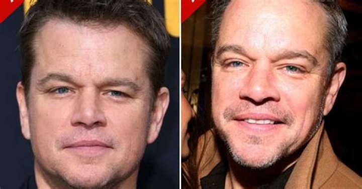 Matt Damon's Resilience Against Plastic Surgery Expectations